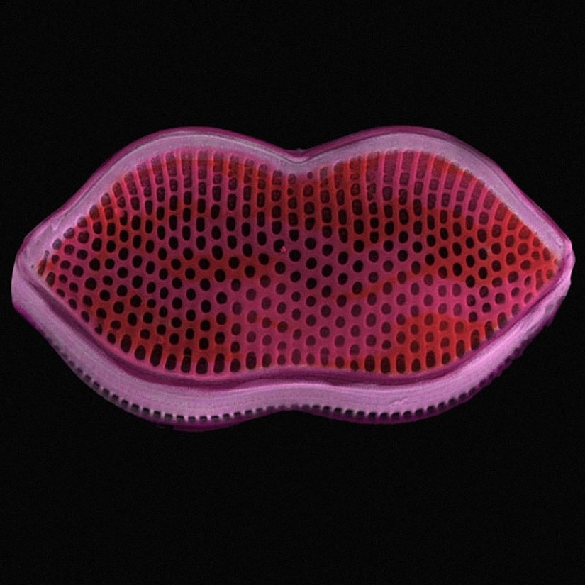 Diatoms: Micrographs by Paul Hargreaves and Fay Darling