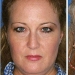 Effects of smoking on the example of twins Effects of smoking on the example of twins