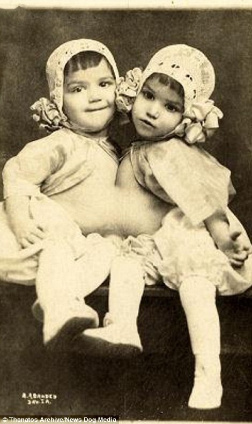 El duro siglo XIX: una colección de fotografías de archivo de personas con deformidades El duro siglo XIX: una colección de fotografías de archivo de personas con deformidades