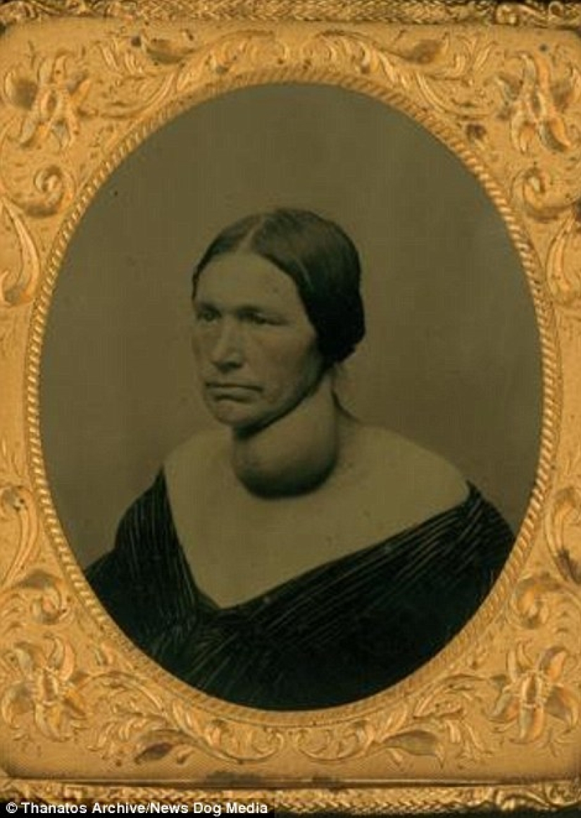 El duro siglo XIX: una colección de fotografías de archivo de personas con deformidades El duro siglo XIX: una colección de fotografías de archivo de personas con deformidades
