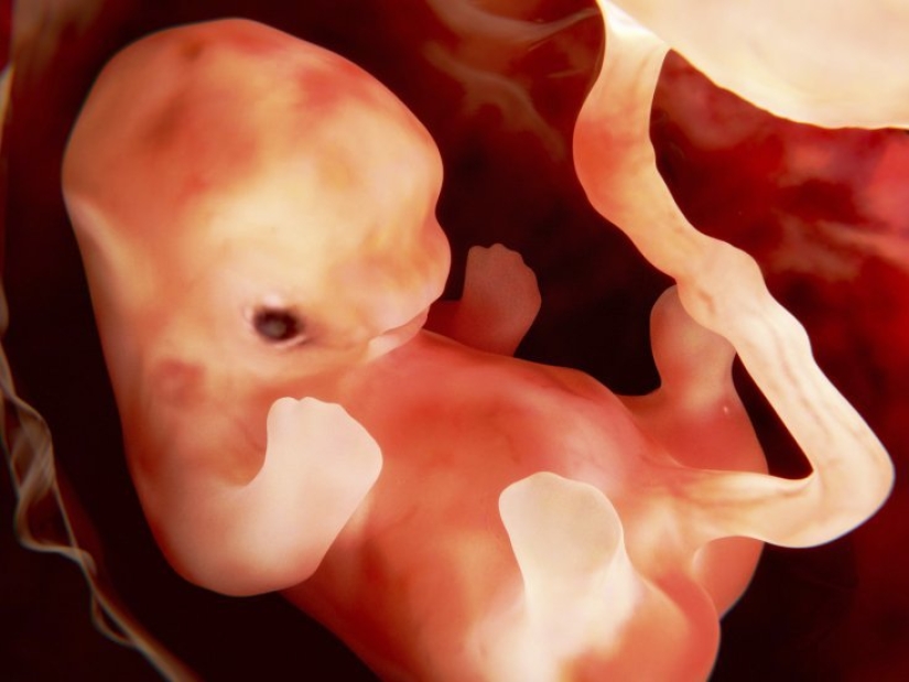 El fenómeno Guevedos: ¿Por qué las niñas en República Dominicana se convierten en niños?