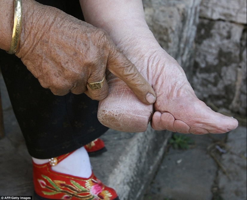 En el pueblo de "Bound Feet" viven las últimas mujeres chinas que sufren de una antigua tradición cruel