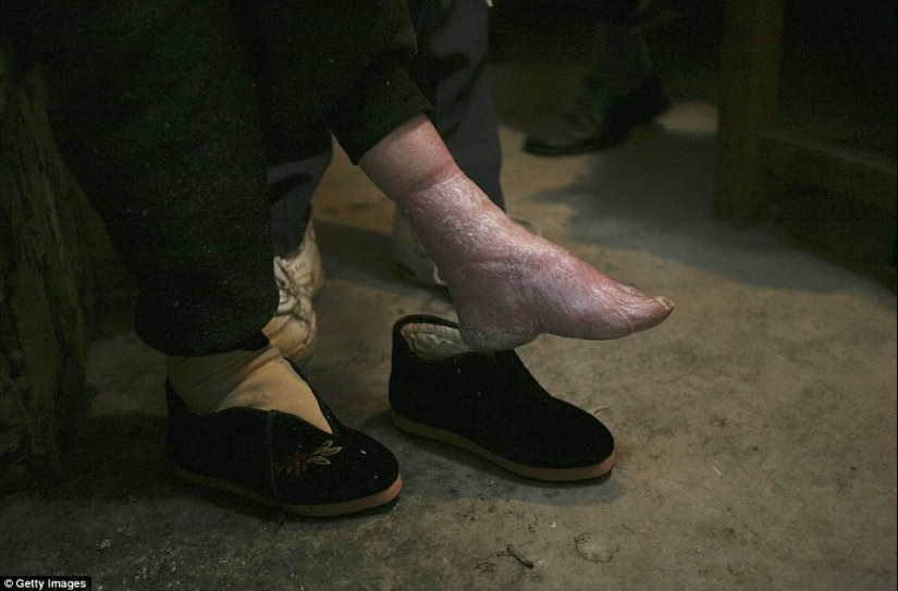 En el pueblo de "Bound Feet" viven las últimas mujeres chinas que sufren de una antigua tradición cruel