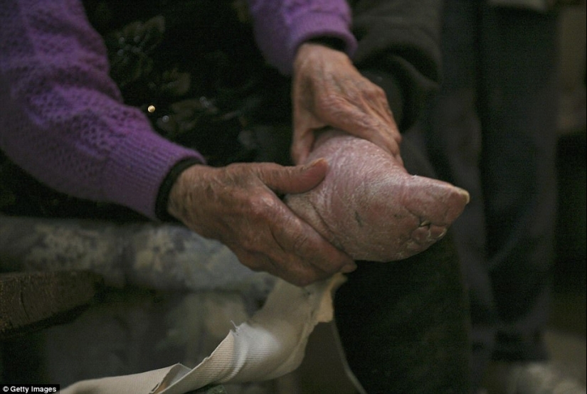 En el pueblo de "Bound Feet" viven las últimas mujeres chinas que sufren de una antigua tradición cruel