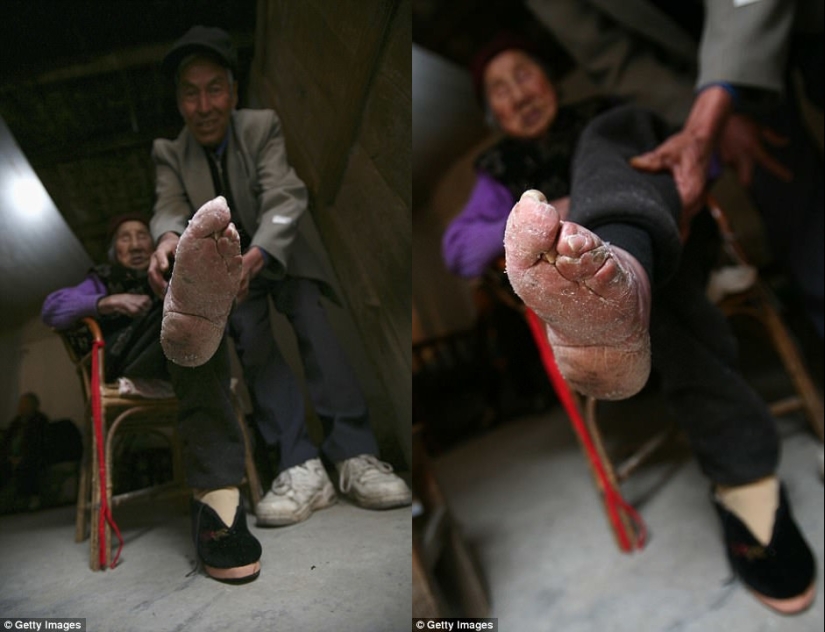 En el pueblo de "Bound Feet" viven las últimas mujeres chinas que sufren de una antigua tradición cruel