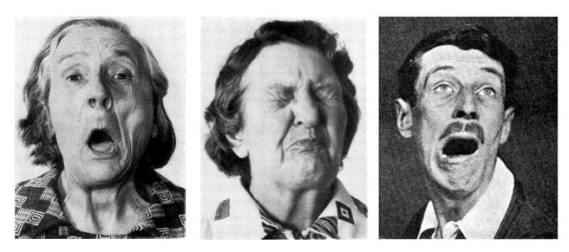 “Enfermedad del sueño”: la historia de una epidemia cuyas causas nunca fueron encontradas “Enfermedad del sueño”: la historia de una epidemia cuyas causas nunca fueron encontradas
