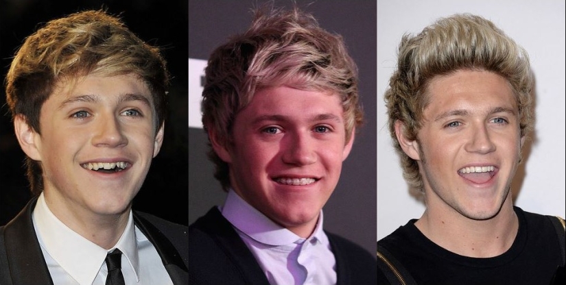 Estas celebridades le mostrarán cómo los frenillos pueden cambiar drásticamente su sonrisa.