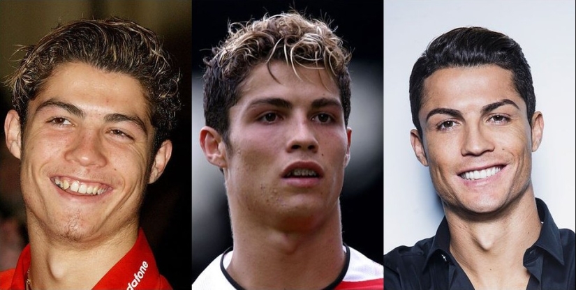 Estas celebridades le mostrarán cómo los frenillos pueden cambiar drásticamente su sonrisa.