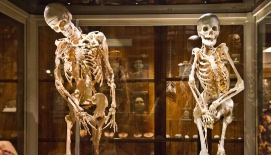 Fibrodysplasia is a terrible disease that turns a person into a bone idol