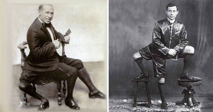 Francesco Lentini - the three-legged "king of freaks" who conquered America Francesco Lentini - the three-legged "king of freaks" who conquered America