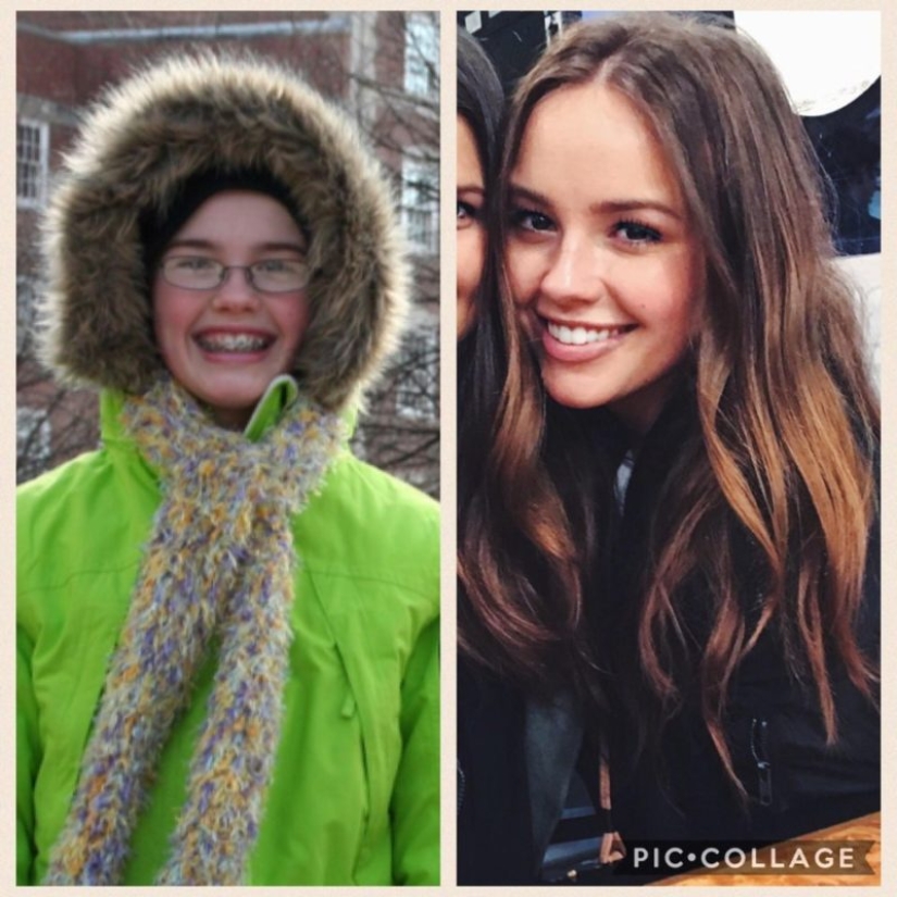 From an ugly duckling to a beautiful swan: these 18 teenagers proved that anyone can become a handsome man From an ugly duckling to a beautiful swan: these 18 teenagers proved that anyone can become a handsome man