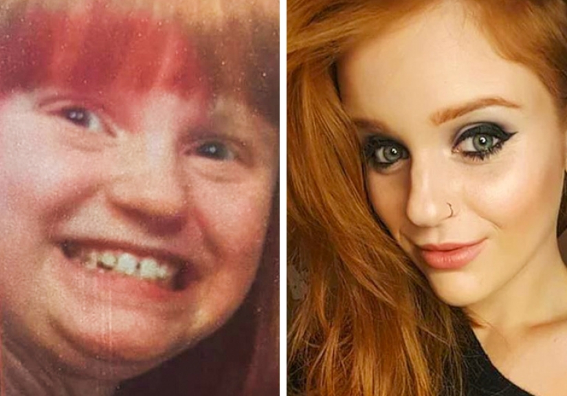 From an ugly duckling to a beautiful swan: these 18 teenagers proved that anyone can become a handsome man From an ugly duckling to a beautiful swan: these 18 teenagers proved that anyone can become a handsome man