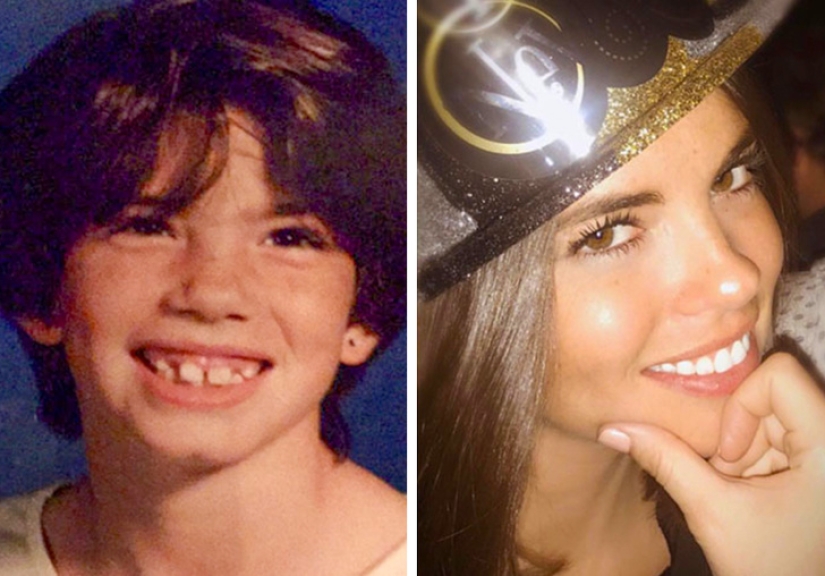 From an ugly duckling to a beautiful swan: these 18 teenagers proved that anyone can become a handsome man From an ugly duckling to a beautiful swan: these 18 teenagers proved that anyone can become a handsome man
