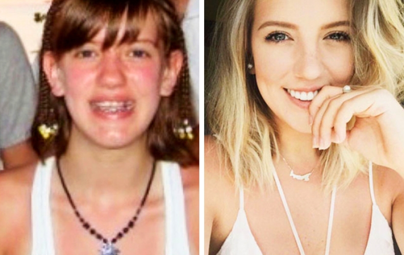 From an ugly duckling to a beautiful swan: these 18 teenagers proved that anyone can become a handsome man From an ugly duckling to a beautiful swan: these 18 teenagers proved that anyone can become a handsome man