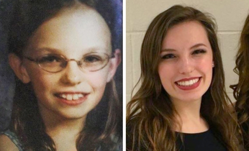 From an ugly duckling to a beautiful swan: these 18 teenagers proved that anyone can become a handsome man From an ugly duckling to a beautiful swan: these 18 teenagers proved that anyone can become a handsome man