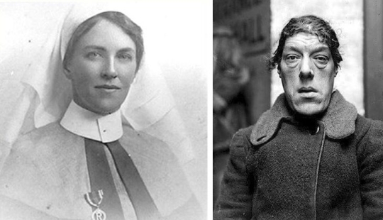 From beauty in the beast: a history of Mary Ann Webster — the most ugly women in the world From beauty in the beast: a history of Mary Ann Webster — the most ugly women in the world