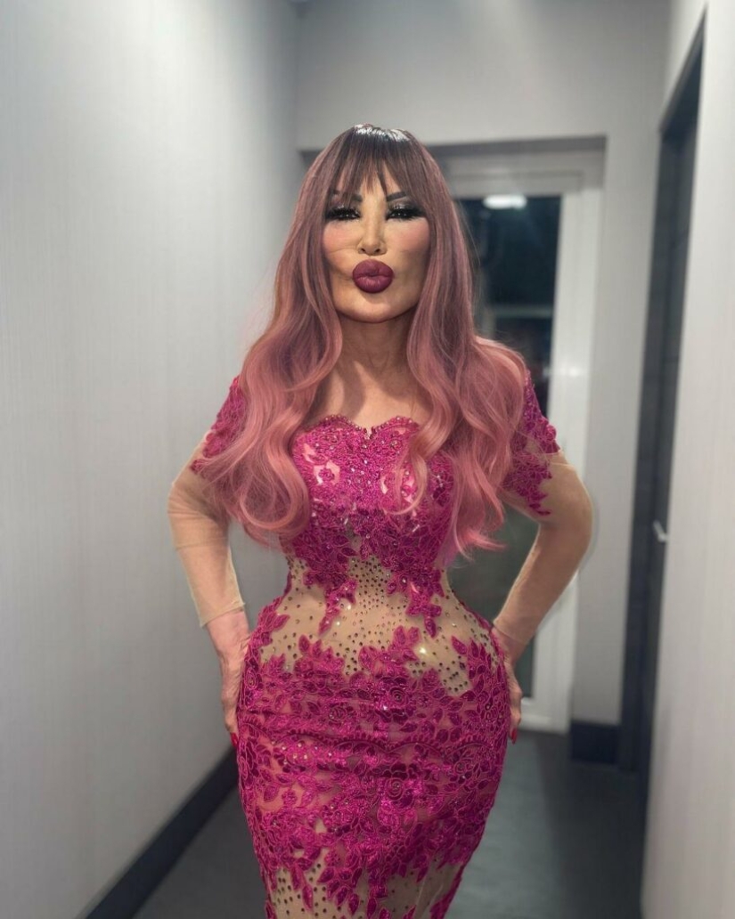 From Beauty to Beast: The Sad Story of Actress Lin Mei Who Was Afraid of Growing Old