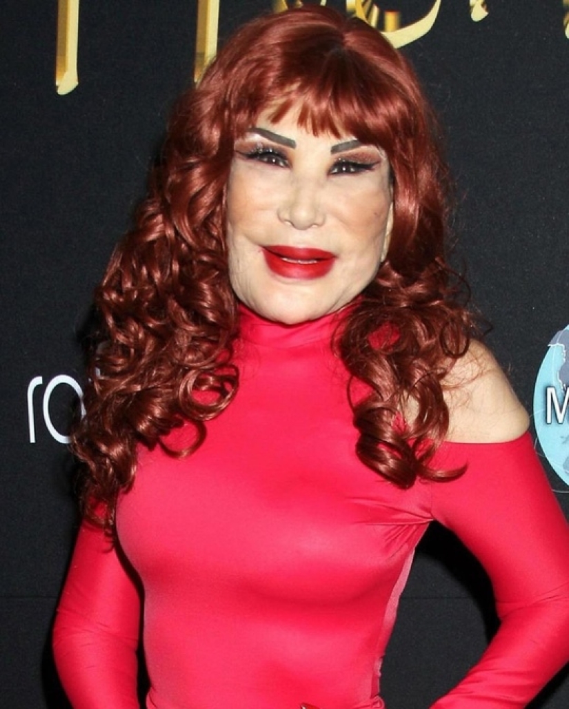 From Beauty to Beast: The Sad Story of Actress Lin Mei Who Was Afraid of Growing Old