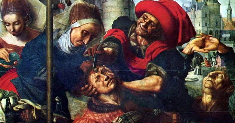 From Hippocrates to Pirogov: military field surgery in different eras From Hippocrates to Pirogov: military field surgery in different eras