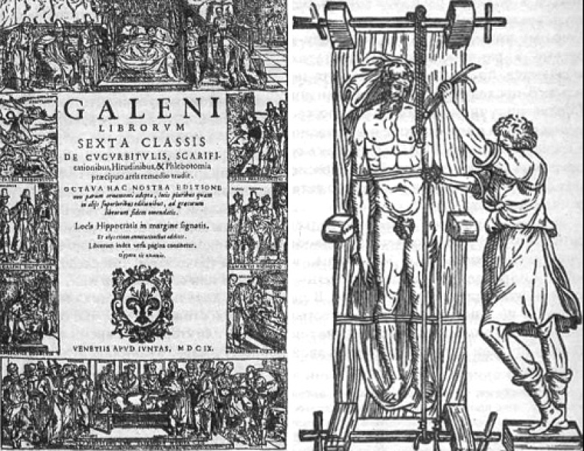From Hippocrates to Pirogov: military field surgery in different eras From Hippocrates to Pirogov: military field surgery in different eras