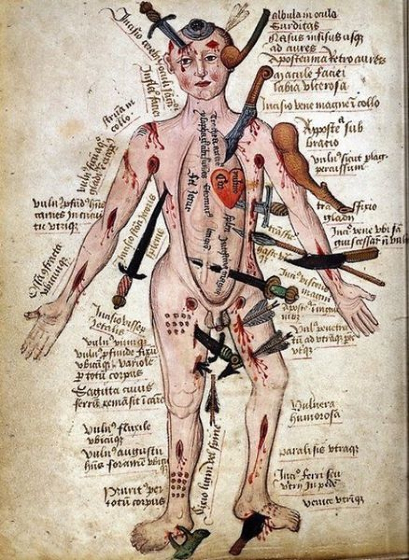 From Hippocrates to Pirogov: military field surgery in different eras From Hippocrates to Pirogov: military field surgery in different eras