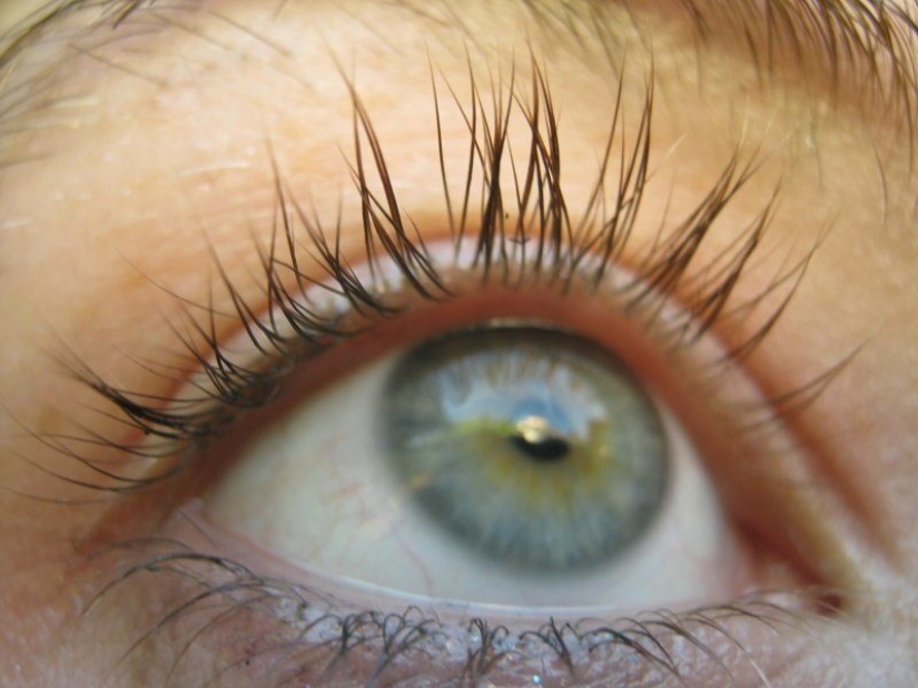 Genetic mutation attractive people Genetic mutation attractive people
