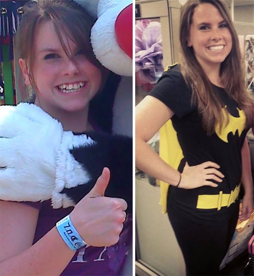 Here's how radically braces change a smile and life
