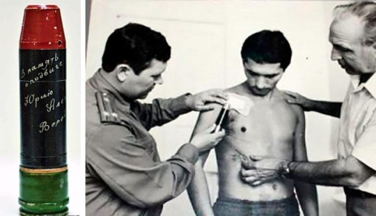 How Soviet surgeons cleared a living person