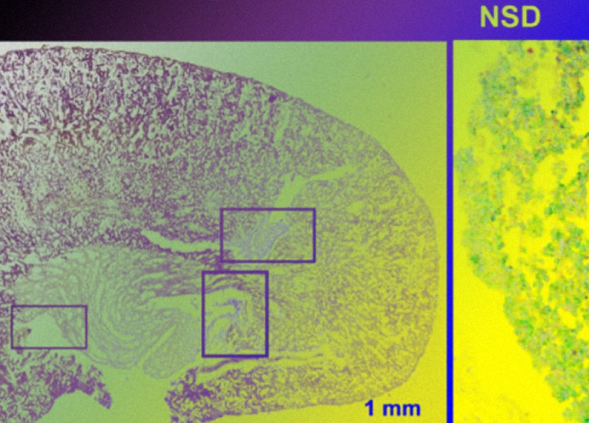 How to subvert the immune system? Eat more salt How to subvert the immune system? Eat more salt