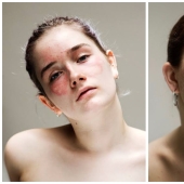 In your skin: a powerful photo project "Epidermis" by Sophie Harris-Taylor In your skin: a powerful photo project "Epidermis" by Sophie Harris-Taylor