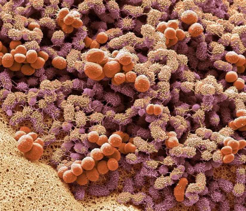 Increíble mundo bajo el microscopio: 22 fotos que te harán ver todo de una manera nueva