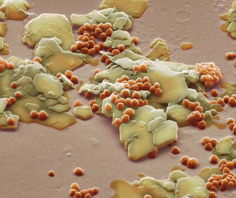 Incredible world under the microscope: 22 photos that will make you see everything in a new way