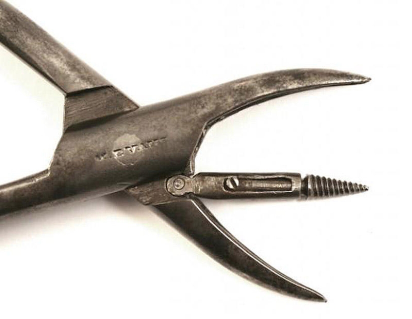 Instrumentos médicos del pasado - instrumentos de tortura o un salvavidas Instrumentos médicos del pasado - instrumentos de tortura o un salvavidas