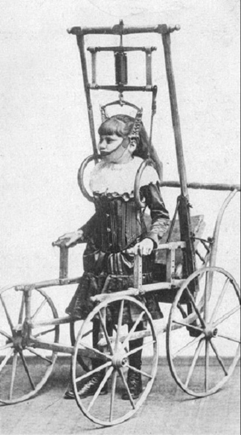 Instrumentos médicos del pasado - instrumentos de tortura o un salvavidas Instrumentos médicos del pasado - instrumentos de tortura o un salvavidas