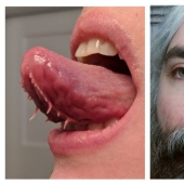 Interesting genetics: 30 people with a rare anomalies Interesting genetics: 30 people with a rare anomalies