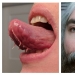 Interesting genetics: 30 people with a rare anomalies Interesting genetics: 30 people with a rare anomalies