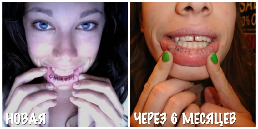 It was-it became: how tattoos age It was-it became: how tattoos age