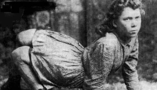 It's hard to believe, but these 5 people with anomalies really existed! It's hard to believe, but these 5 people with anomalies really existed!