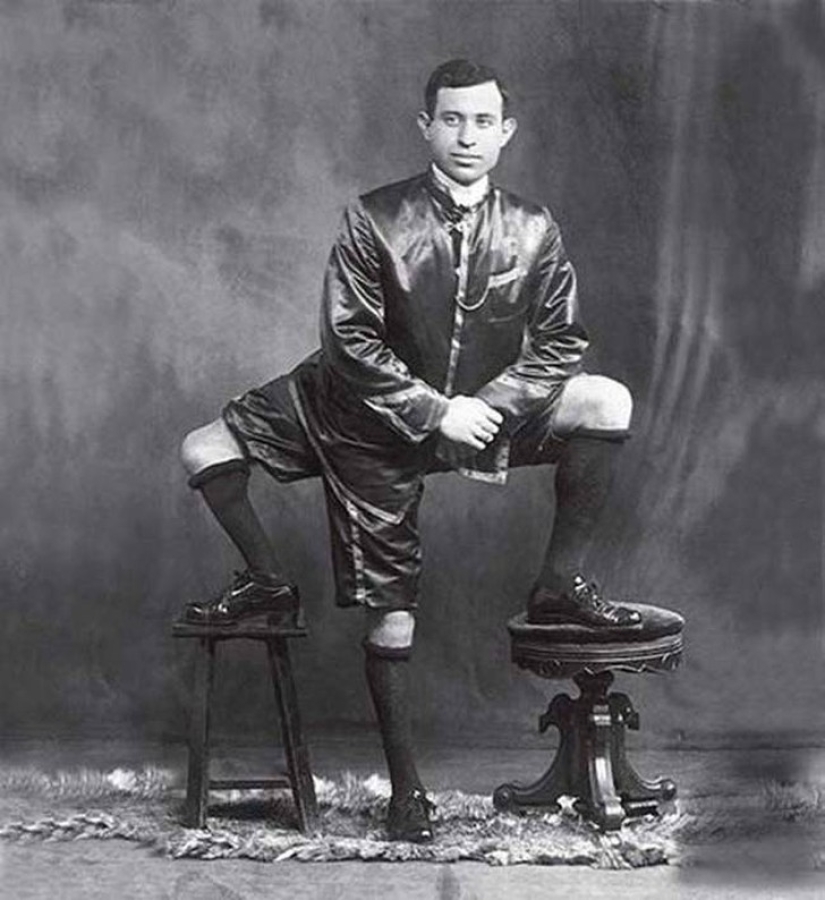 It's hard to believe, but these 5 people with anomalies really existed!