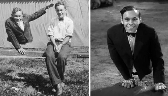Johnny Eck, the &quot;king of the freaks&quot; who was born with half a body
