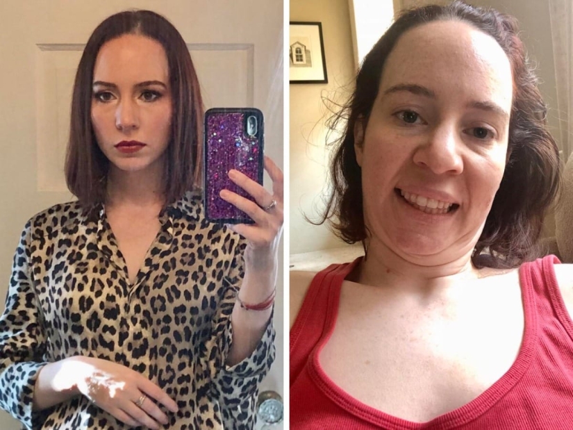 La Bella y la Bestia: 22 chicas que no tienen miedo de ser imperfectas La Bella y la Bestia: 22 chicas que no tienen miedo de ser imperfectas
