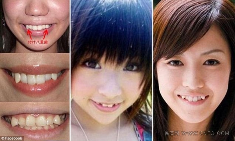 La belleza de los dientes torcidos, almohadas para solteros y otros hechos sorprendentes sobre Japón La belleza de los dientes torcidos, almohadas para solteros y otros hechos sorprendentes sobre Japón