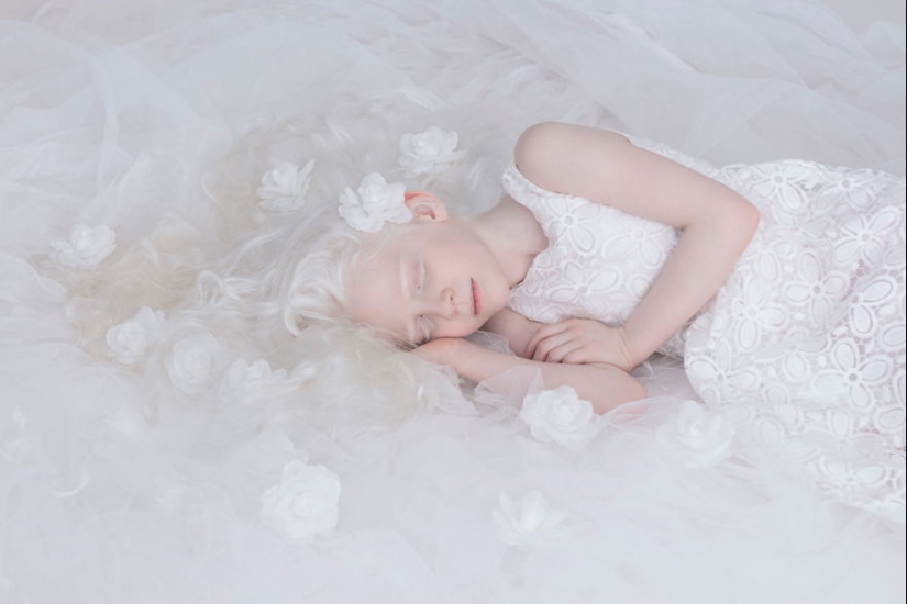 La belleza hipnótica de los albinos en el proyecto fotográfico de Yulia Taits