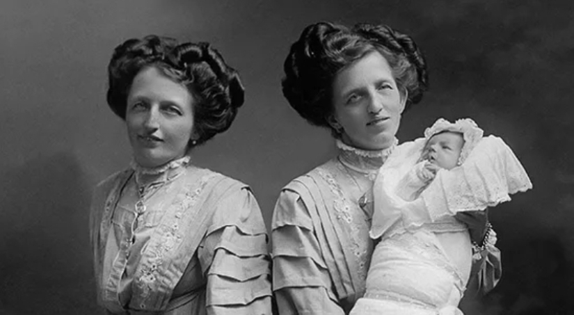 La historia de dos siamesas, las hermanas Blazek, una de las cuales dio a luz a un niño.