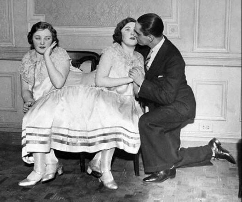 La historia de dos siamesas, las hermanas Blazek, una de las cuales dio a luz a un niño.