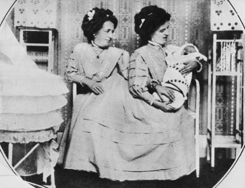 La historia de dos siamesas, las hermanas Blazek, una de las cuales dio a luz a un niño.