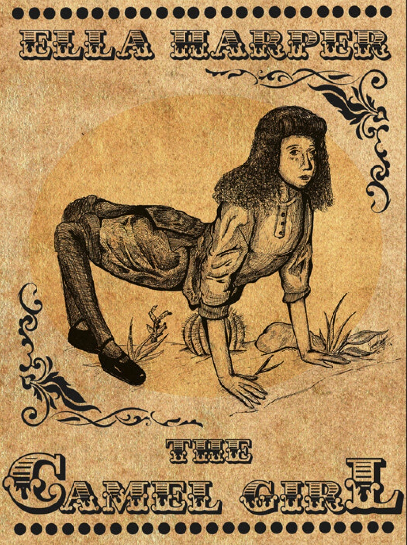 La historia de Ella Harper, que se hizo famosa como la "niña camello" La historia de Ella Harper, que se hizo famosa como la "niña camello"