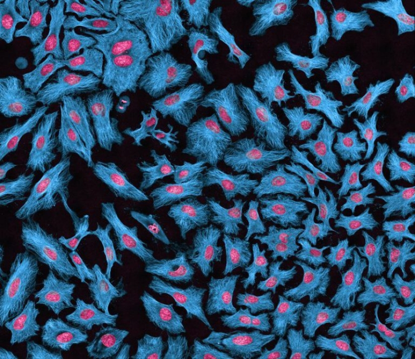 La historia de Henrietta Lacks, la mujer que revolucionó la ciencia mundial después de su muerte