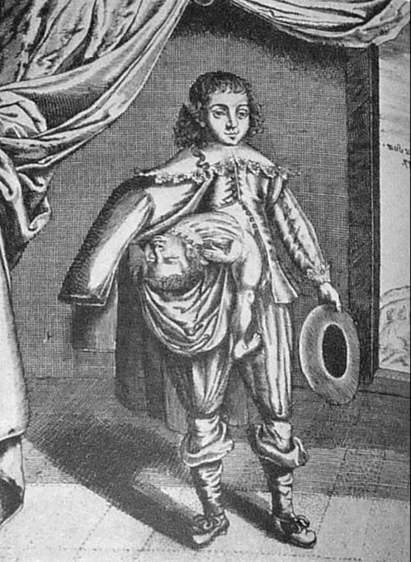 La historia de los gemelos siameses Colloredo, que lograron convertirse en mosqueteros del rey de Francia