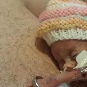 La increíble historia de un pequeño bebé que sobrevivió sin importar qué La increíble historia de un pequeño bebé que sobrevivió sin importar qué